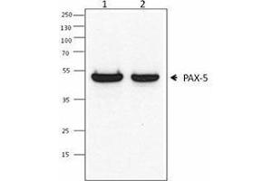 Western Blotting (WB) image for anti-Paired Box 5 (PAX5) antibody (ABIN2667347) (PAX5 抗体)