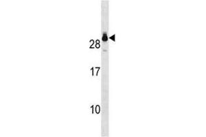 GSTT2 antibody western blot analysis in A549 lysate. (GSTT2 抗体  (AA 113-141))