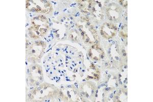 Immunohistochemistry of paraffin-embedded rat kidney using NEDD4L antibody (ABIN6132407, ABIN6144504, ABIN6144505 and ABIN6224109) at dilution of 1:200 (40x lens). (NEDD4-2 抗体  (AA 836-955))