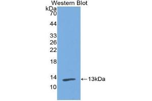 Western blot analysis of the recombinant protein. (PIGR 抗体  (AA 230-331))