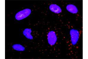 Proximity Ligation Analysis of protein-protein interactions between CDK6 and CDKN1B. (CDK6 抗体  (AA 1-326))