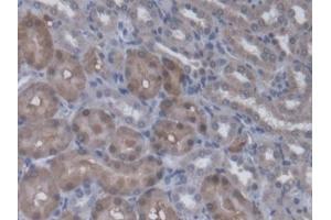 DAB staining on IHC-P; Samples: Rat Kidney Tissue (Regucalcin 抗体  (AA 1-299))