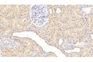 Detection of Hsp60 in Human Kidney Tissue using Monoclonal Antibody to Heat Shock Protein 60 (Hsp60)