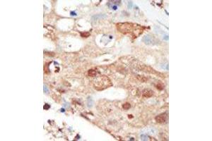 Image no. 2 for anti-Phosphoinositide 3 Kinase, p85 beta (PI3K p85b) (C-Term) antibody (ABIN360460) (PIK3R2 抗体  (C-Term))