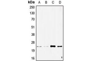 Western blot analysis of STMN2 expression in SHSY5Y (A), NIH3T3 (B), A549 (C), rat brain (D) whole cell lysates. (STMN2 抗体  (Center))