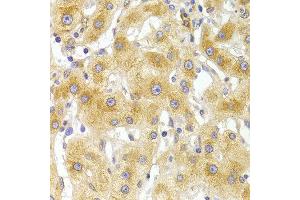 Immunohistochemistry of paraffin-embedded Human liver injury using EIF4G1 antibody at dilution of 1:100 (x400 lens). (EIF4G1 抗体)