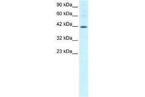 Human Jurkat; WB Suggested Anti-MIER1 Antibody Titration: 1. (MIER1 抗体  (Middle Region))