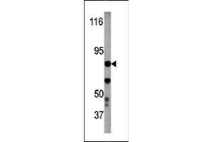 Image no. 1 for anti-Inhibitor of kappa Light Polypeptide Gene Enhancer in B-Cells, Kinase beta (IKBKB) (pTyr199) antibody (ABIN358141) (IKBKB 抗体  (pTyr199))