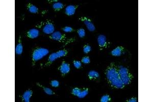 IF analysis of GRASP65/GORASP1 using anti-GRASP65/GORASP1 antibody (ABIN7599953). (GORASP1 抗体  (AA 130-440))