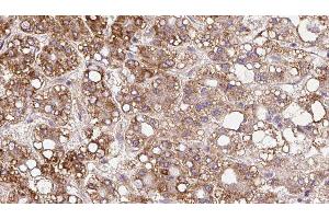 Immunohistochemistry (IHC) image for anti-Solute Carrier Family 6 (Proline IMINO Transporter), Member 20 (SLC6A20) (Internal Region) antibody (ABIN6265146)