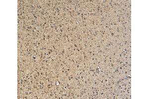 Immunohistochemistry (IHC) image for anti-Gastrulation Brain Homeo Box 2 (GBX2) (Internal Region) antibody (ABIN334408)