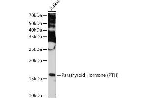 Western blot analysis of extracts of Jurkat cells, using Parathyroid Hormone (PTH) (PTH) Rabbit mAb (ABIN7269175) at 1:1000 dilution. (PTH 抗体)