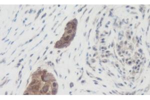 Immunohistochemistry (IHC) image for anti-Wingless-Type MMTV Integration Site Family, Member 1 (WNT1) antibody (ABIN2477142)