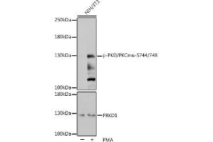 Western blot analysis of extracts of NIH/3T3 cells, using Phospho-PKC mu-S744/748 pAb (ABIN7269641) at 1:1000 dilution or PRKD1 antibody (ABIN7269644). (PKC mu 抗体  (pSer744, pSer748))