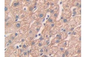 Detection of MMP24 in Human Liver Tissue using Polyclonal Antibody to Matrix Metalloproteinase 24 (MMP24)