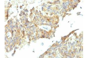 Image no. 2 for anti-Alkaline Phosphatase (ALP) antibody (ABIN6155884) (Alkaline Phosphatase 抗体)