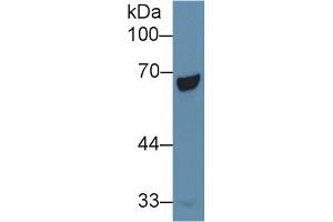Detection of PCK1 in Human Liver lysate using Polyclonal Antibody to Phosphoenolpyruvate Carboxykinase 1, Soluble (PCK1) (PCK1 抗体  (AA 311-558))