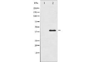 Western blot analysis of MKK3 expression in MDA-MB-435 whole cell lysates,The lane on the left is treated with the antigen-specific peptide. (MAP2K3 抗体  (Internal Region))