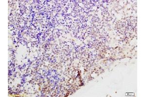 Immunohistochemistry (Paraffin-embedded Sections) (IHC (p)) image for anti-Cyclin G1 (CCNG1) (AA 181-295) antibody (ABIN685837)