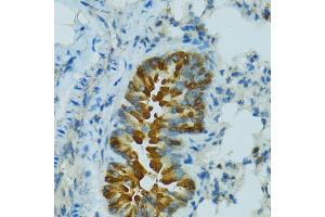 Immunohistochemistry of paraffin-embedded mouse lung using CYP2B6 antibody. (CYP2B6 抗体)