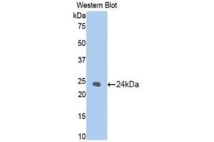 Western blot analysis of the recombinant protein. (Caspase 1 抗体  (AA 119-296))