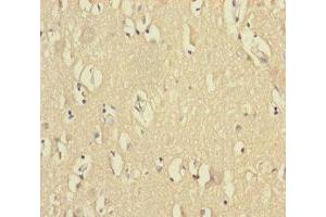 Immunohistochemistry of paraffin-embedded human brain tissue using ABIN7175313 at dilution of 1:100