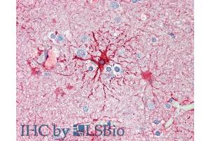Immunohistochemistry (IHC) image for anti-Glial Fibrillary Acidic Protein (GFAP) (C-Term) antibody (ABIN185730)