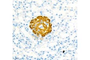 Immunohistochemistry (Paraffin-embedded Sections) (IHC (p)) image for anti-Mucosal Vascular Addressin Cell Adhesion Molecule 1 (MADCAM1) antibody (ABIN7074695)