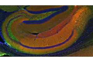 Indirect immunostaining of a PFA fixed mouse hippocampus section with anti-homer 1b/c (dilution 1 : 200; red) and mouse anti-synapsin 1 (cat.