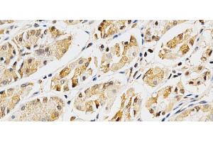 Immunohistochemistry of paraffin-embedded Human stomach using LGALS3 Polyclonal Antibody at dilution of 1:200 (40x lens). (Galectin 3 抗体)