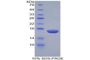 SDS-PAGE analysis of Human Epsin 1 Protein. (Epsin 1 Protein (EPN1))