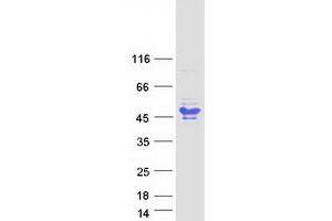 Western Blotting (WB) image for B-Cell CLL/lymphoma 7A (BCL7A) (Transcript Variant 2) protein (Myc-DYKDDDDK Tag) (ABIN2715206)
