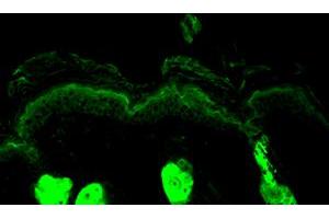 Calreticulin, Mouse backskin. (Calreticulin 抗体)