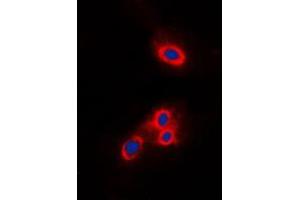 Immunofluorescent analysis of VAV2 staining in THP1 cells. (VAV2 抗体  (N-Term))