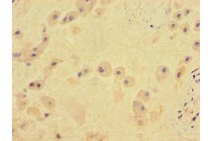 Immunohistochemistry of paraffin-embedded human placenta tissue using ABIN7171961 at dilution of 1:100 (TGFBR2 抗体  (AA 25-159))
