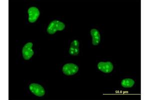 Immunofluorescence of monoclonal antibody to HMGB1 on HeLa cell. (HMGB1 抗体  (AA 1-215))