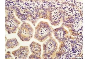 Formalin-fixed and paraffin embedded mouse embryo labeled with Rabbit Anti-MAP4 Polyclonal Antibody, Unconjugated (ABIN754243) at 1:200 followed by conjugation to the secondary antibody and DAB staining (MAP4 抗体  (AA 701-800))