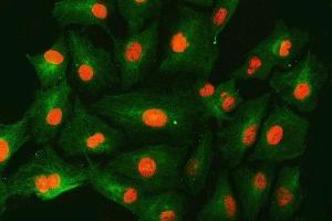 IF analysis of SNF2H/SMARCA5 and Tubulin beta using anti-SNF2H/SMARCA5 antibody (ABIN7602001) and anti-Tubulin beta antibody (ABIN7602744).