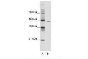 Image no. 1 for anti-DEAD (Asp-Glu-Ala-Asp) Box Polypeptide 25 (DDX25) (AA 355-404) antibody (ABIN6736105) (DDX25 抗体  (AA 355-404))
