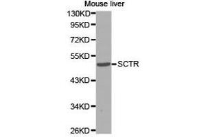 Western Blotting (WB) image for anti-Secretin Receptor (SCTR) antibody (ABIN1874706) (SCTR 抗体)