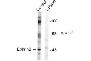 Western blots of rat testes lysate showing specific immunolabeling of the ~46k EphrinB phosphorylated at Tyr317 (Control). (EPH Receptor B2 抗体  (pTyr317))
