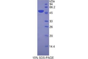 SDS-PAGE analysis of Mouse LEFTY1 Protein. (LEFTY1 蛋白)