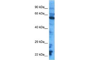 Host:  Rabbit  Target Name:  CY24B  Sample Tissue:  HepG2 Whole Cell lysates  Antibody Dilution:  1. (CYBB 抗体  (C-Term))