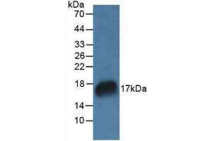 Detection of RNASE7 in Rat Marrow Tissue using Polyclonal Antibody to Ribonuclease A7 (RNASE7) (RNASE7 抗体  (AA 31-155))