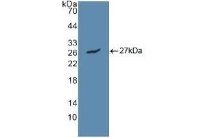 Detection of Recombinant LIPC, Human using Polyclonal Antibody to Lipase, Hepatic (LIPC) (LIPC 抗体  (AA 25-247))