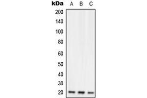 Western blot analysis of RGS10 expression in Jurkat (A), Raw264. (RGS10 抗体  (Center))