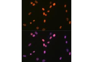 Immunofluorescence analysis of NIH-3T3 cells using DHX9/DHX9/RNA Helicase A Rabbit mAb (ABIN7265747) at dilution of 1:100 (40x lens). (DHX9 抗体)
