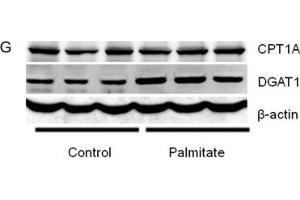 Western Blotting (WB) image for anti-Actin, beta (ACTB) antibody (ABIN3020544)