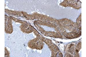 IHC-P Image TTC11 antibody detects TTC11 protein at mitochondria on mouse prostate by immunohistochemical analysis. (Fission 1 抗体  (full length))