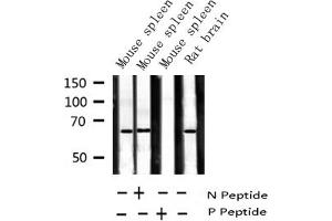 Western blot analysis of Phospho-NF kappaB p65 (Ser281) expression in various lysates (NF-kB p65 抗体  (pSer281))